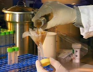 Medical Detectives - Geheimnisse der Gerichtsmedizin - Tödliche Bakterien